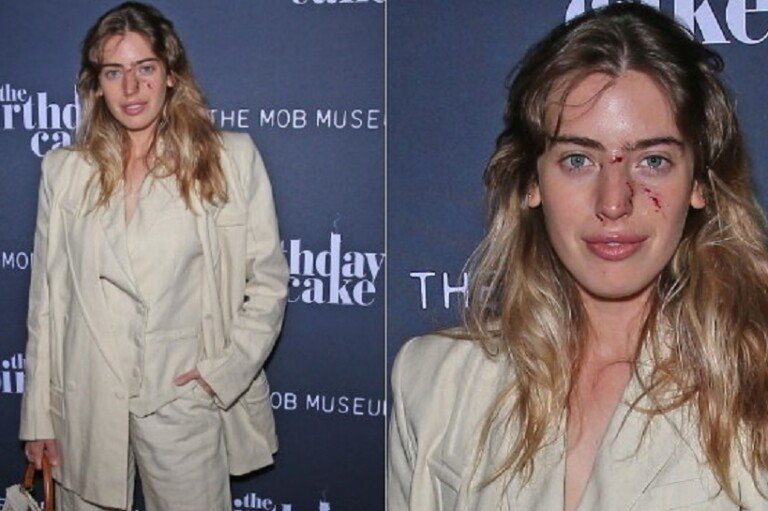 Clara McGregor posou em evento mesmo após ser mordida por cachorro
MJT/ADMEDIA /SIPA USA/THE GROSBY GROUP