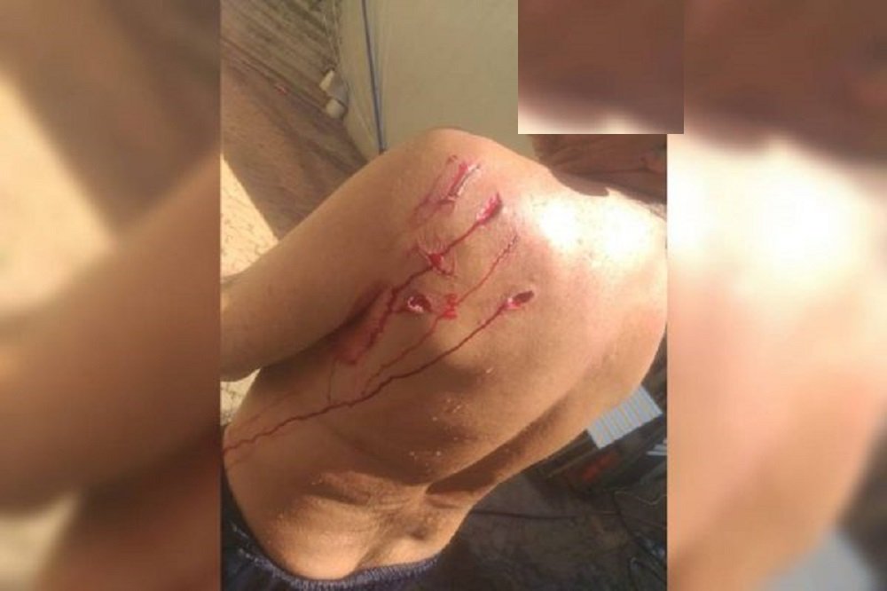 Imagem forte: veja como ficou corpo de marinheiro após ataque de capivara