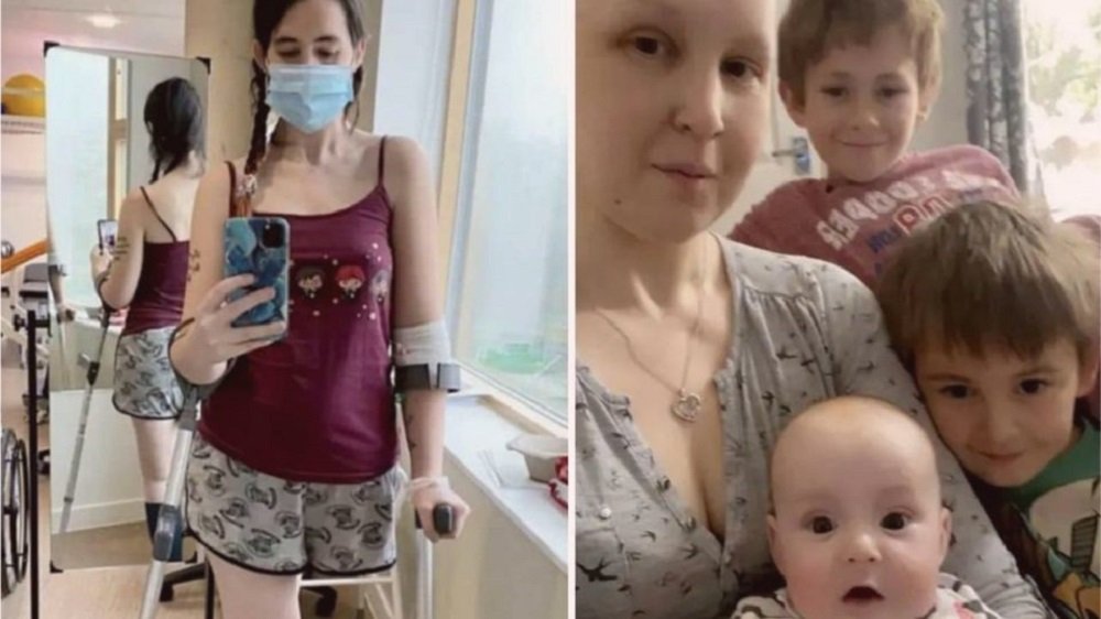 Para não abortar filha, mãe decide amputar perna após diagnóstico de câncer