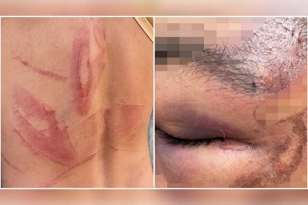 Casal denuncia patrões por sessão de tortura que durou 3h em Goiás