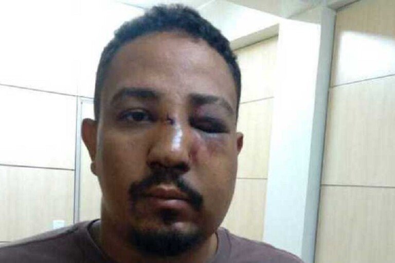 vitima-de-agressor-em-sobradinho-ii-11022022093304678 (1)