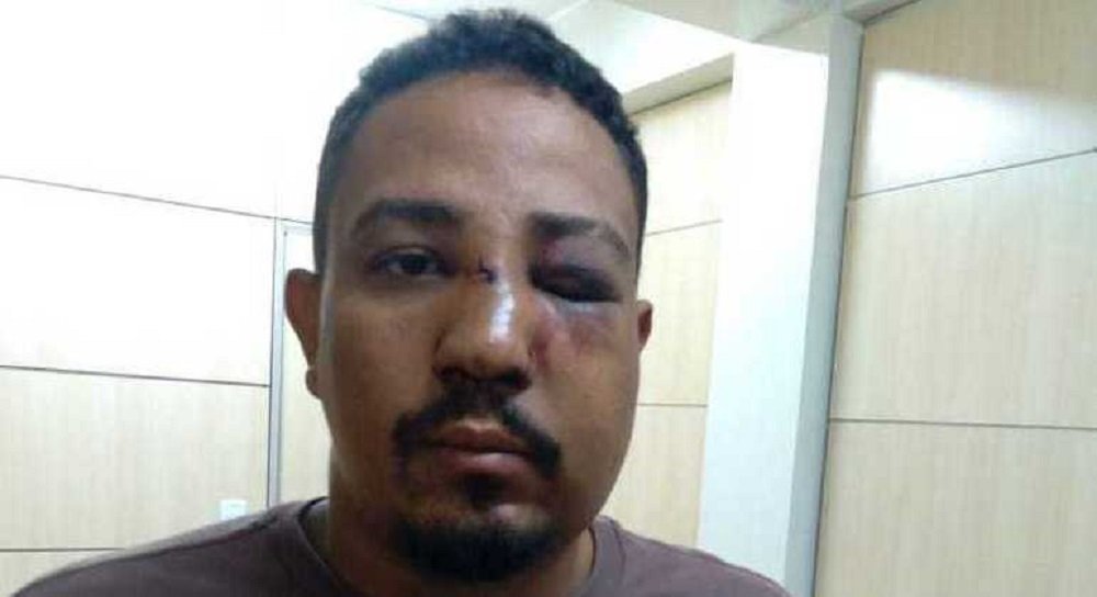 Inconformado com leitura de tarô, homem espanca cartomante no DF