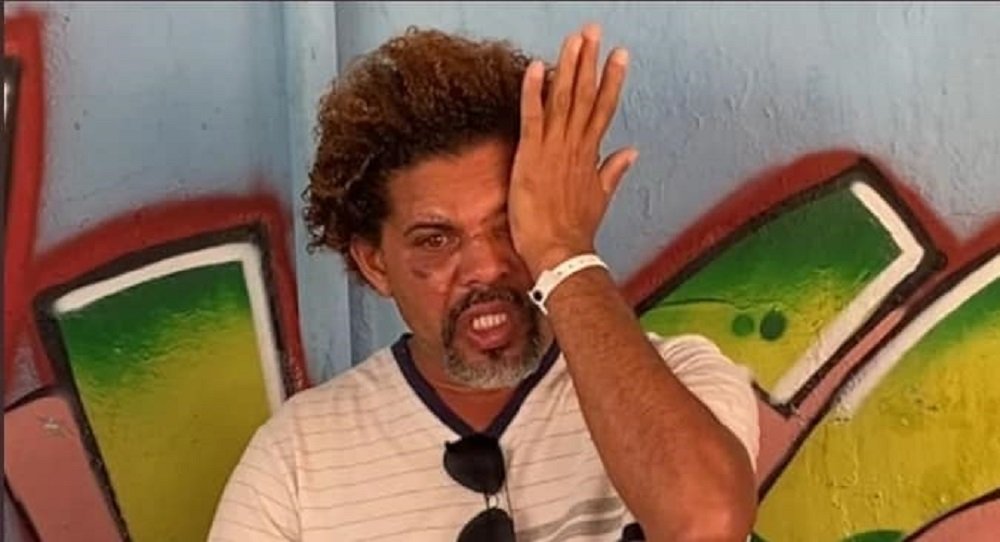 Morador de rua agredido por personal fala pela 1° vez: “não me arrependo”
