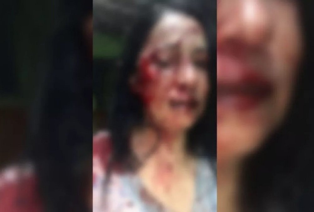 Após denunciar som alto Mulher é espancada por nove vizinhos em Palmital (SP