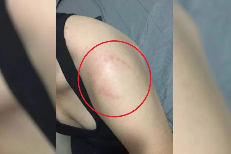 Mulher leva mordida na Academia