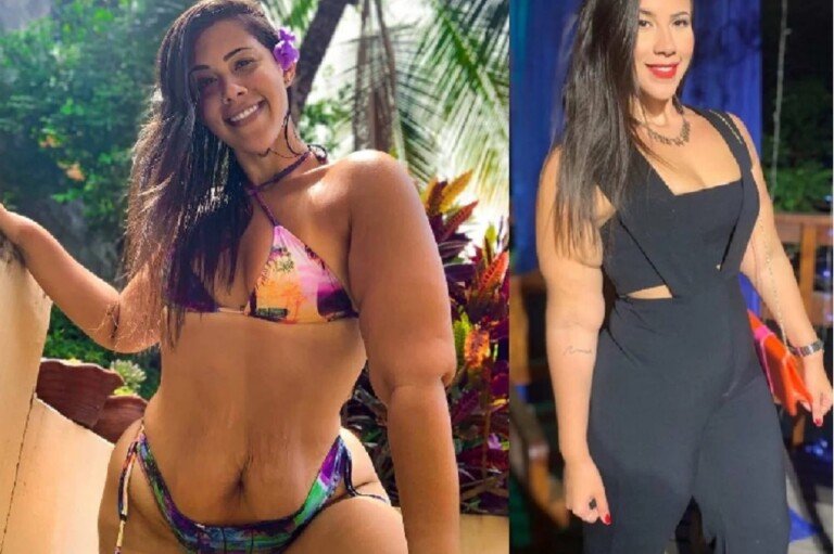 EX OBESA