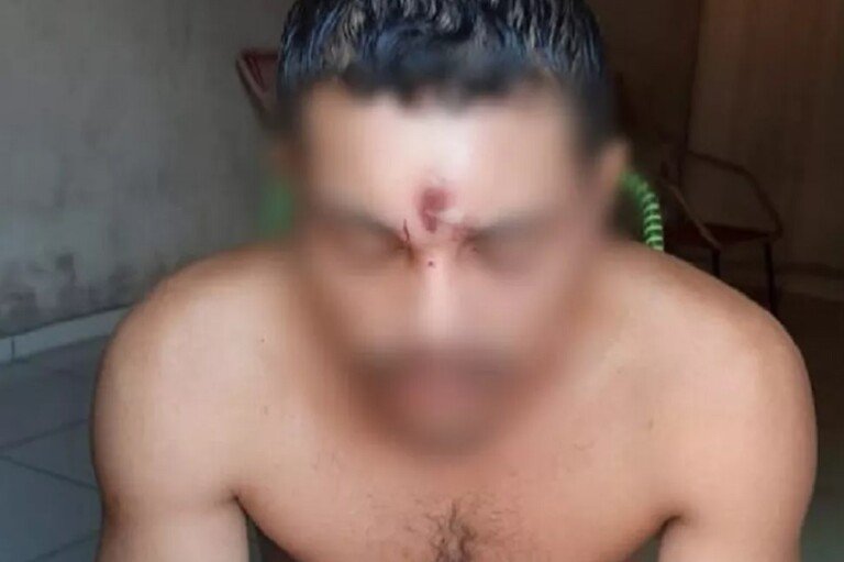 Homem leva tiro na testa
