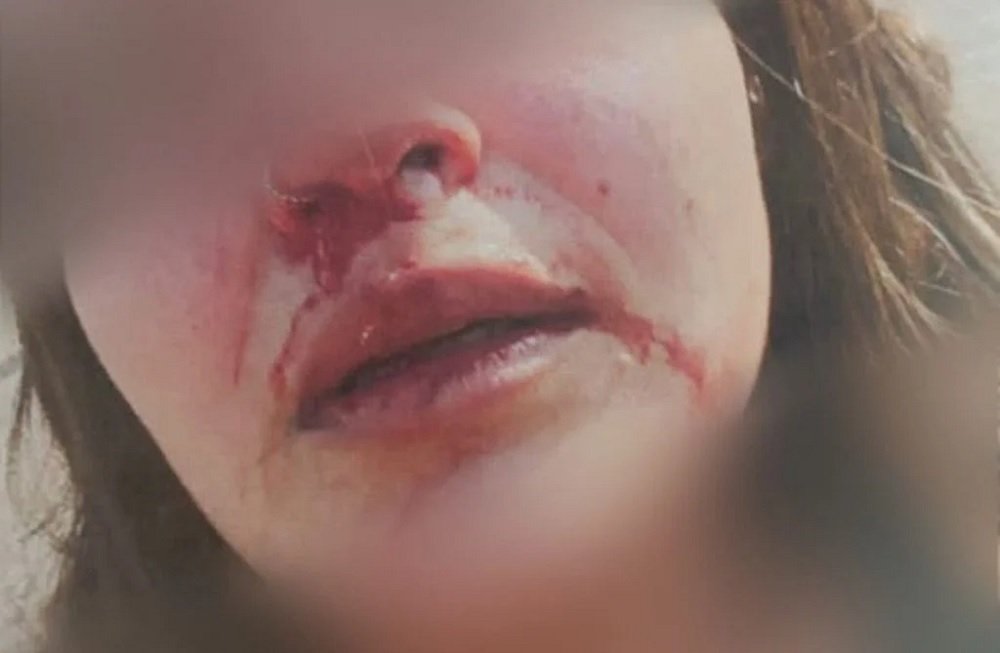 Ex é preso por espancar e quebrar unhas de jovem em Goiânia