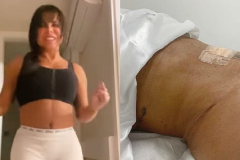 gretchen-lipo-hd-24082022181709784
