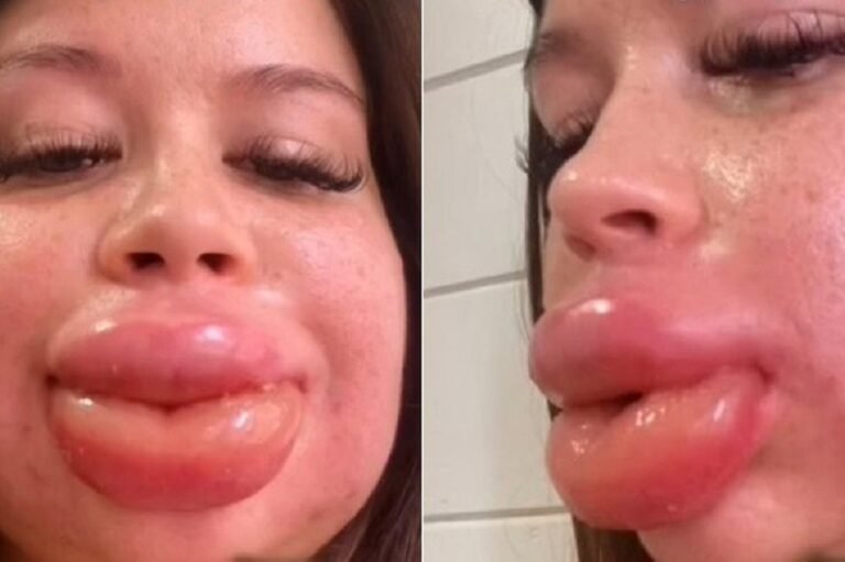 labios-tamanho-preenchimento-05092022175310139