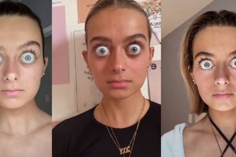 mulher-viraliza-no-tiktok-por-causa-de-olhos-enormes-e-confessa-que-caracteristica-a-valoriza-24102022135304697