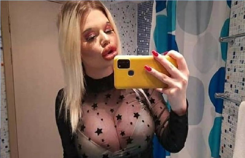 Jovem dona dos ‘maiores lábios do mundo’ agora quer ter o ‘queixo mais longo’ do planeta