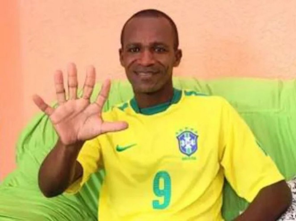 Baiano com seis dedos pretende comemorar hexa da seleção com uma mão só: “Fico ansioso”