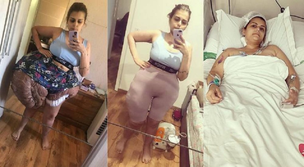 Mulher e TUMOR NA PERNA
